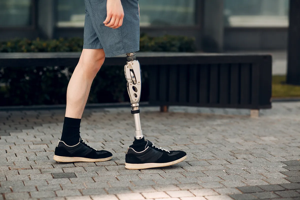 Amputee walking down sidewalk